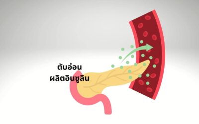 วิธีวัดและแก้ไขภาวะดื้อต่ออินซูลิน – คู่มือฉบับสมบูรณ์